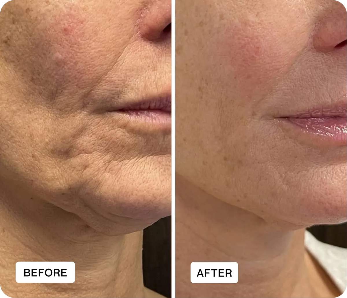 Rejunas customer before and after result 2