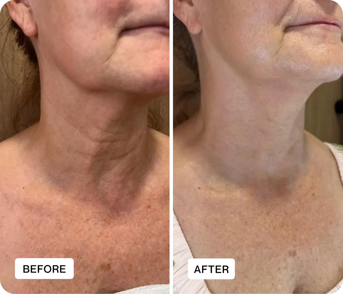 Rejunas customer before and after result 3