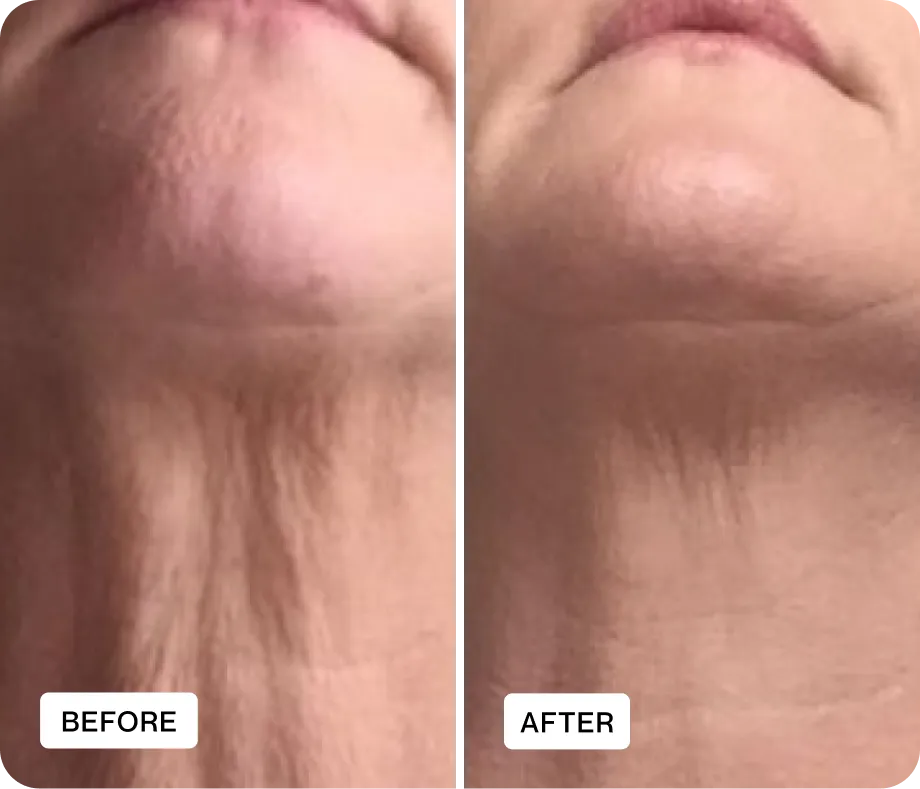 Rejunas customer before and after result 1